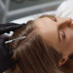 Is Mesotherapy Effective For Hair Growth?