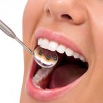 The Latest High-Tech Braces Options Available Today